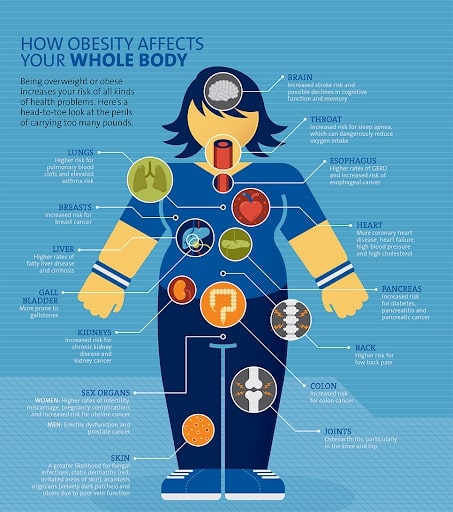 How Obesity Affects Your Whole Body