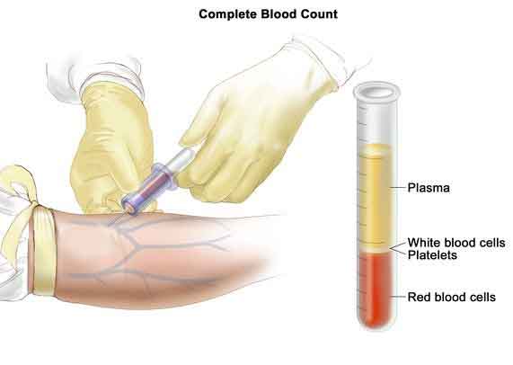 Complete Blood Count with Differential
