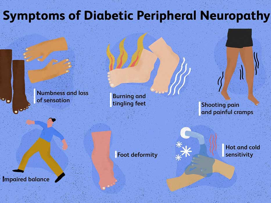 Symptoms of Diabetic Peripheral Neuropathy