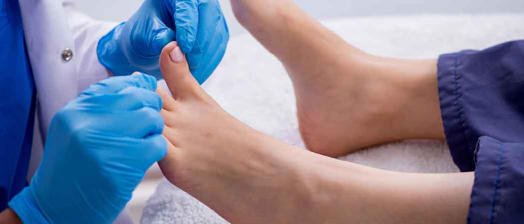 Diabetic foot Neuropathy