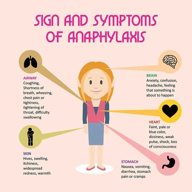 Anaphylactic Shock Symptoms