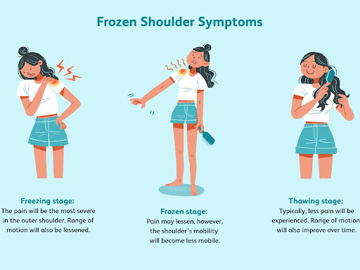 Symptoms of Frozen Shoulder