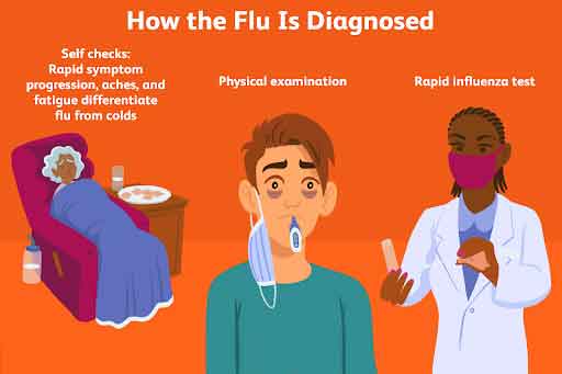How the Flu is Diagnosed