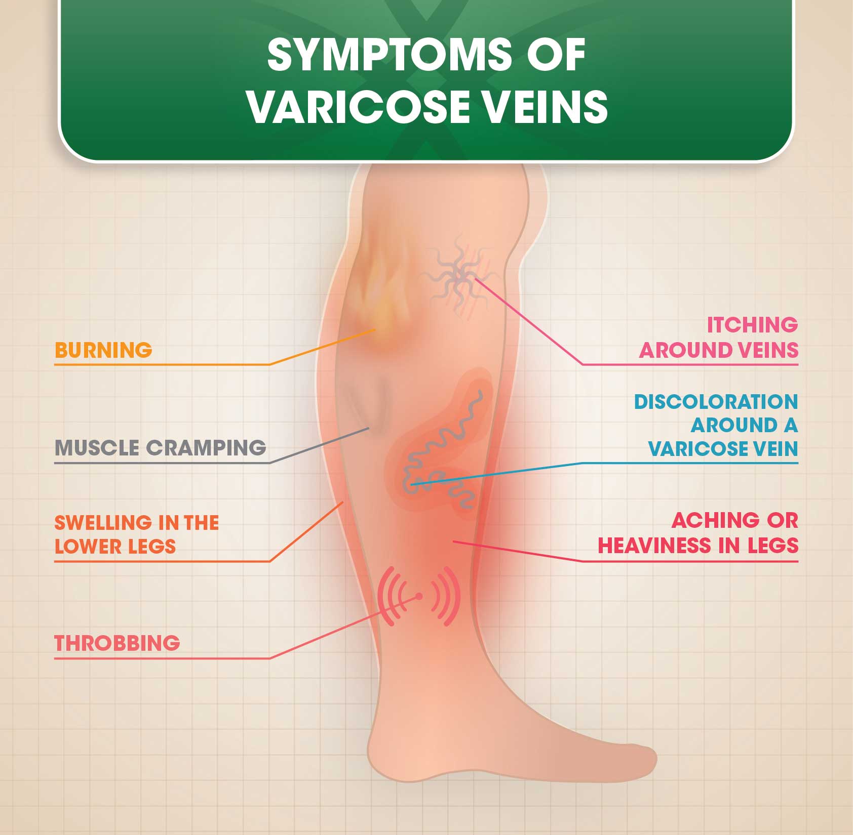 Symptoms of Varicose Veins
