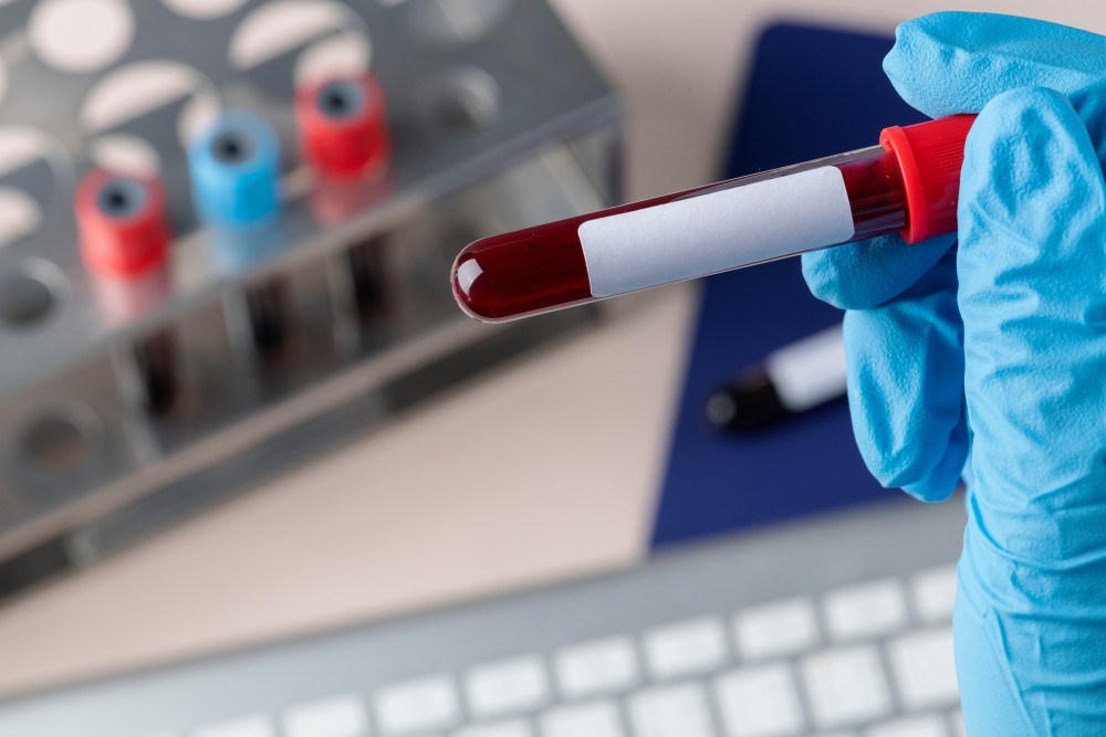 Blood Testing Clinic Midland TX
